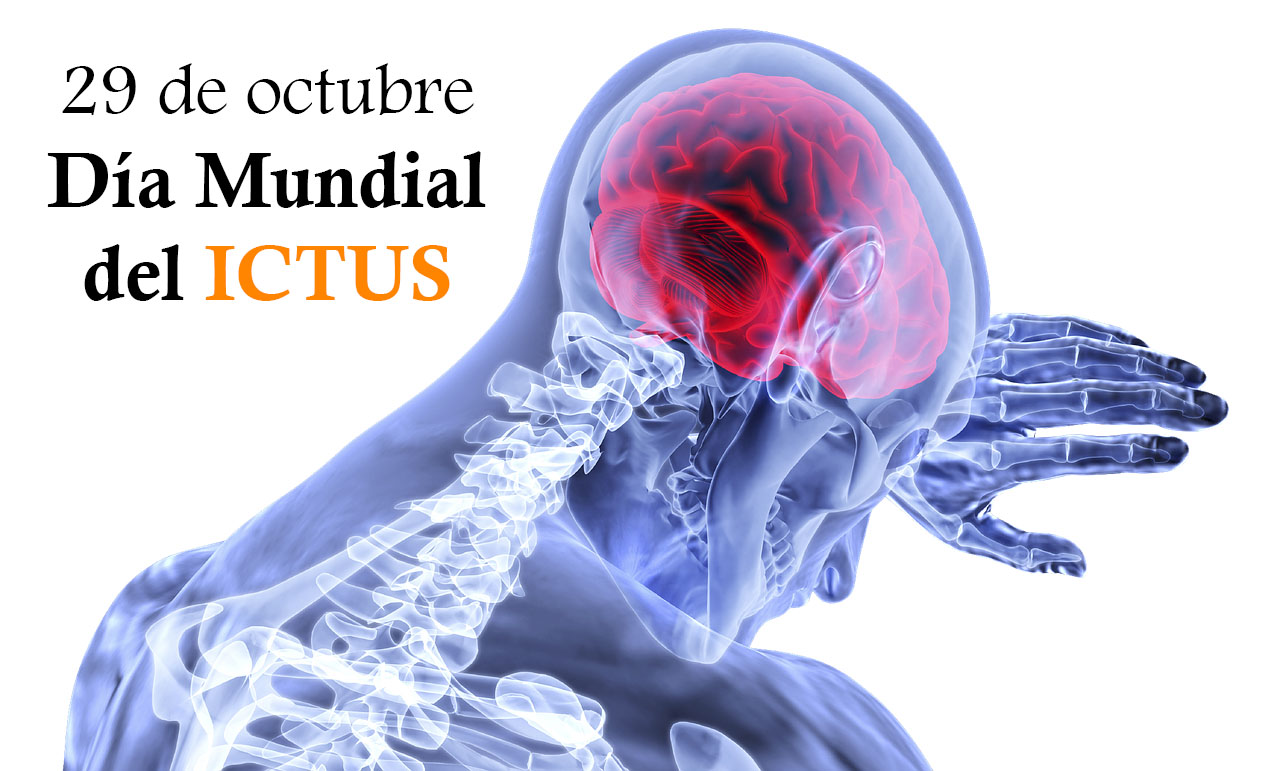 Lee más sobre el artículo Día Mundial del Ictus: prevenir para evitar